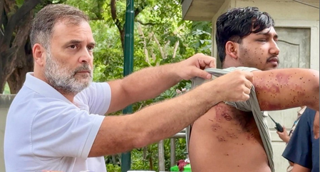 Politics intensifies over claims of pellet gun injuries; Rahul Gandhi arrives at Parliament Street Police Station with an injured student.